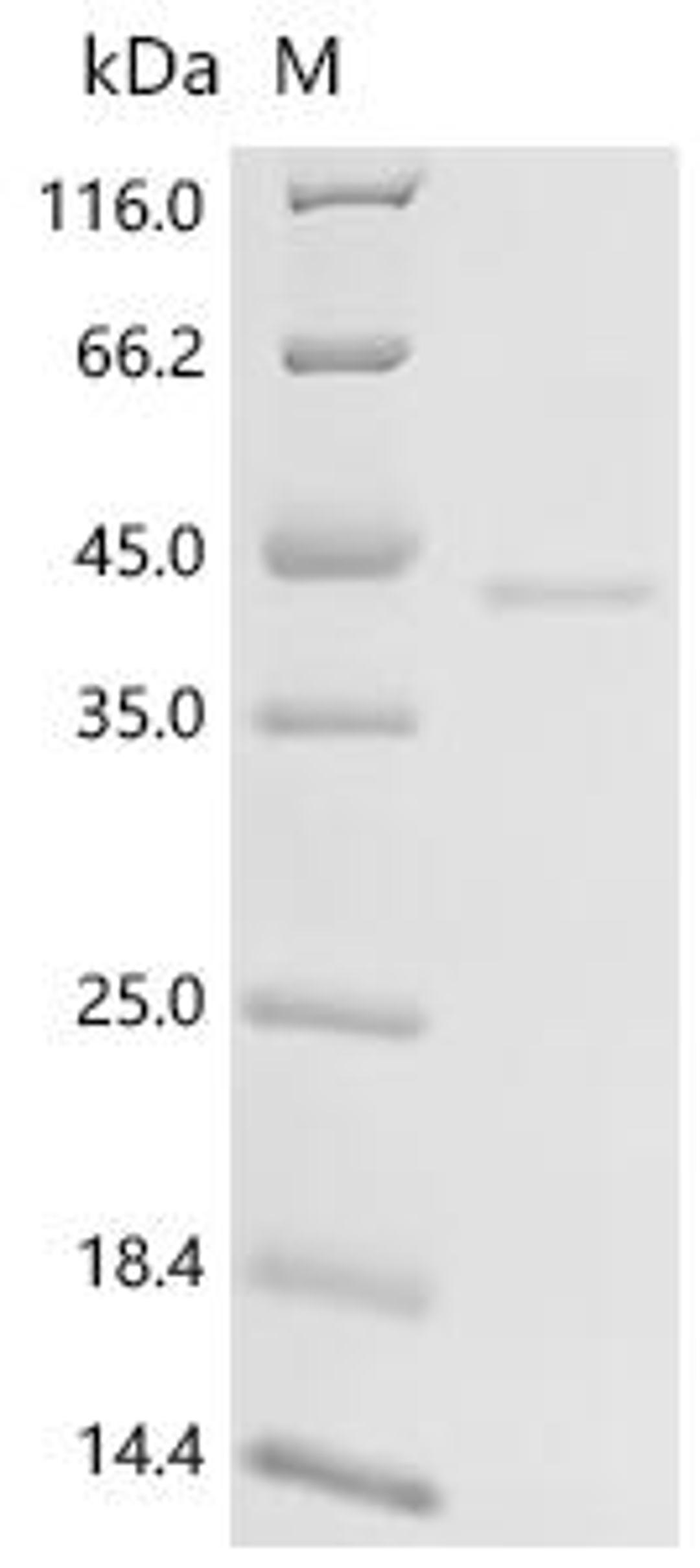 (Tris-Glycine gel) Discontinuous SDS-PAGE (reduced) with 5% enrichment gel and 15% separation gel.
