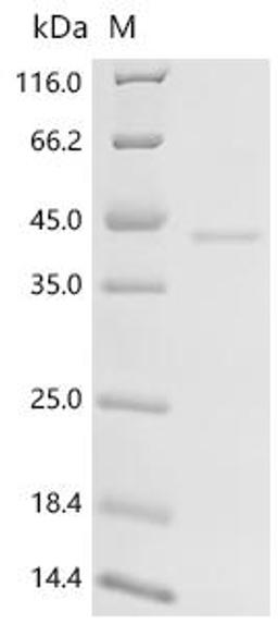 (Tris-Glycine gel) Discontinuous SDS-PAGE (reduced) with 5% enrichment gel and 15% separation gel.