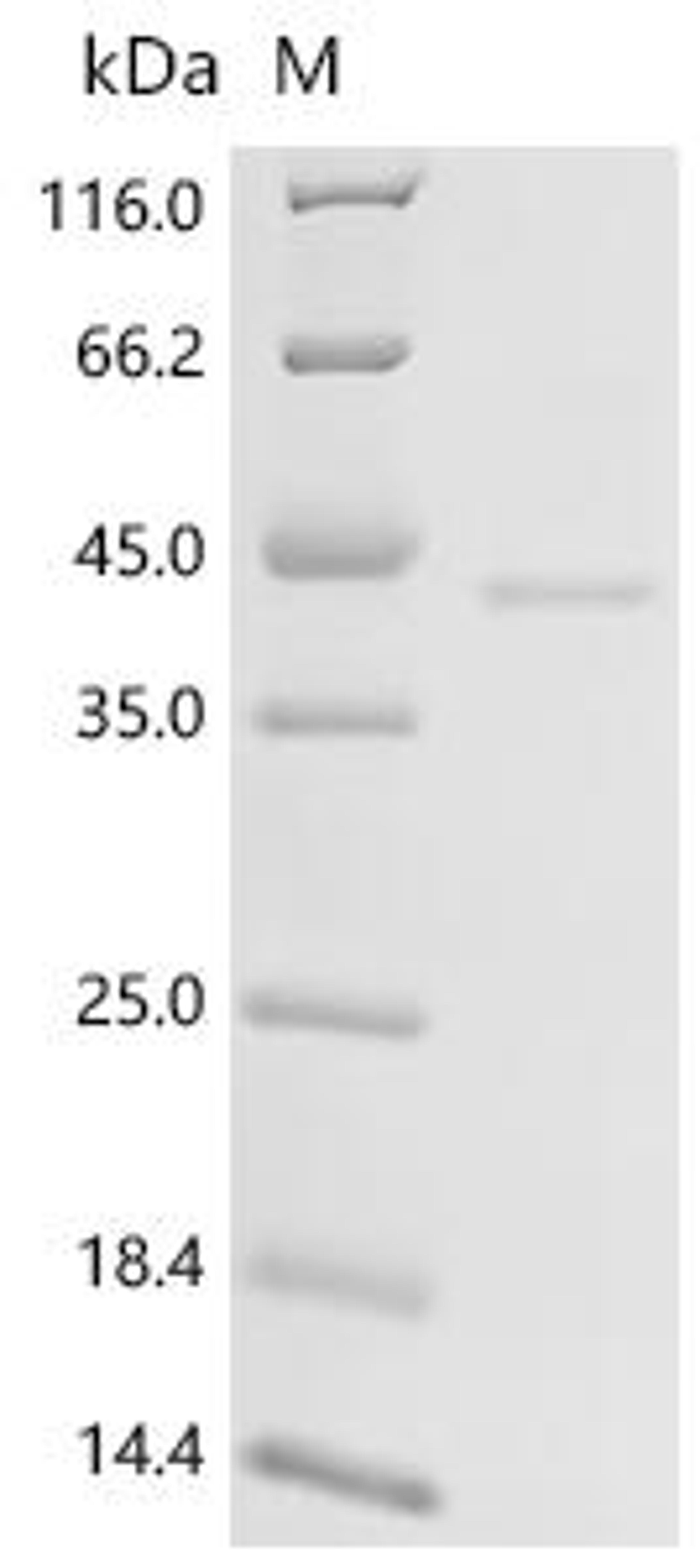 (Tris-Glycine gel) Discontinuous SDS-PAGE (reduced) with 5% enrichment gel and 15% separation gel.