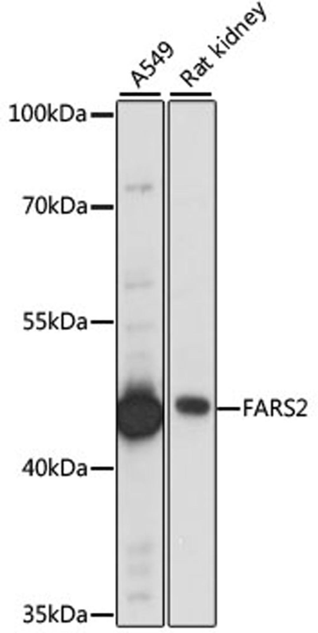 Western blot - FARS2 antibody (A15246)