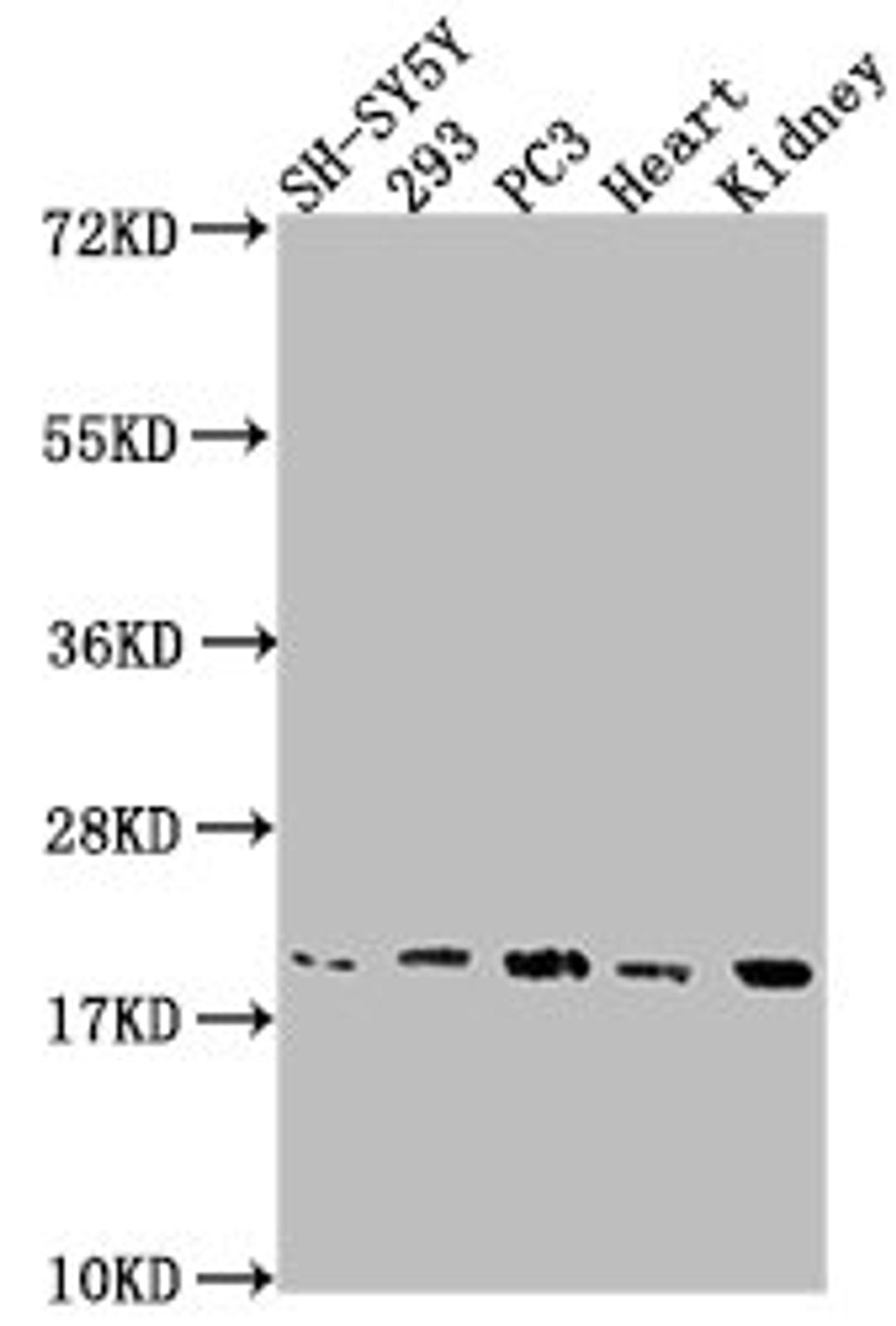 Western Blot. Positive WB detected in: SH-SY5Y whole cell lysate, 293 whole cell lysate, PC3 whole cell lysate, Mouse heart tissue, Mouse kidney tissue. All lanes: PYCARD antibody at 1:2000. Secondary. Goat polyclonal to rabbit IgG at 1/50000 dilution. Predicted band size: 22, 20, 16 kDa. Observed band size: 20 kDa. 