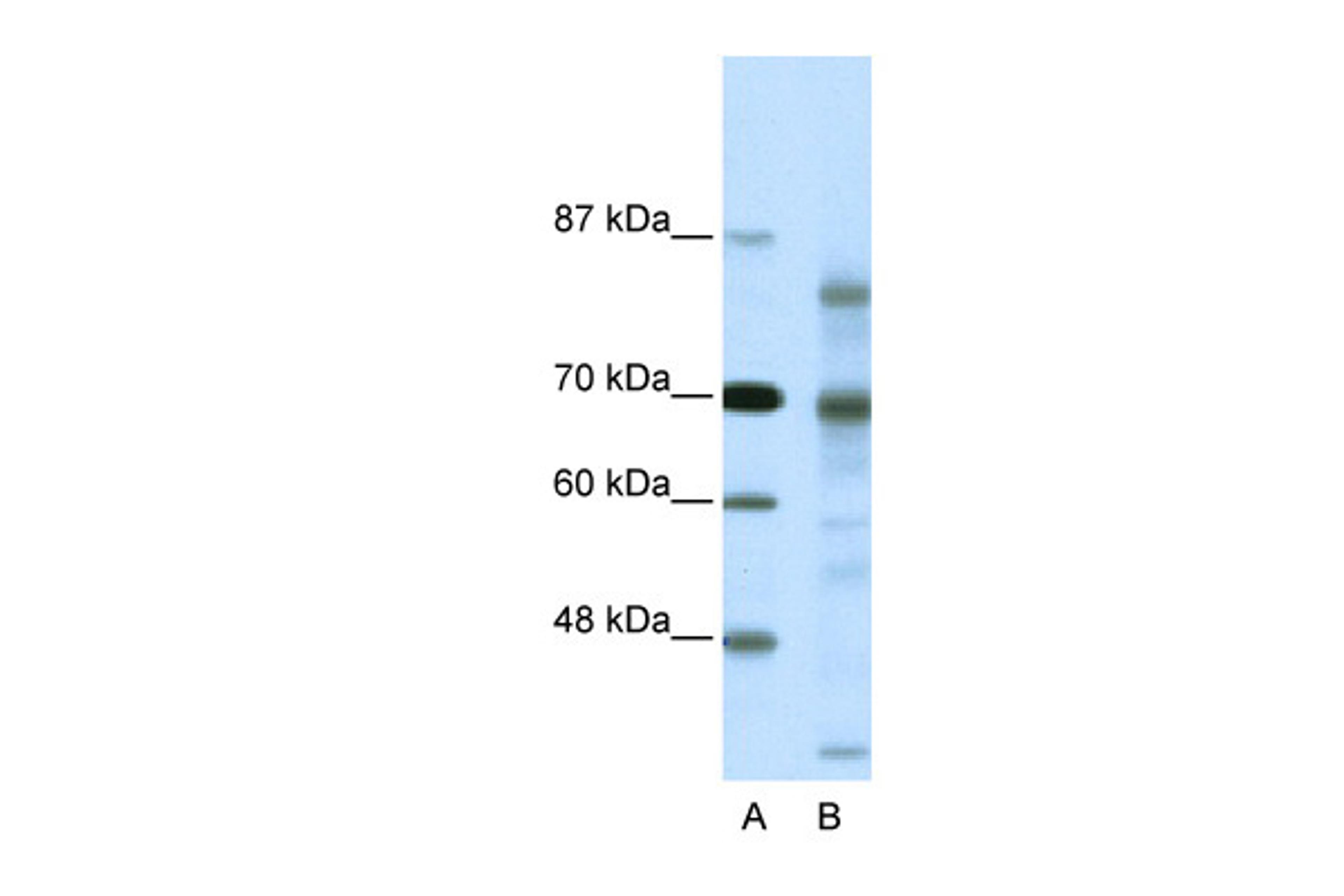 Antibody used in WB on Human HeLa at 0.2-1 ug/ml.