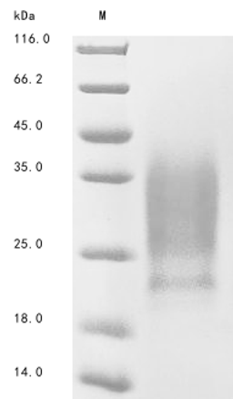 (Tris-Glycine gel) Discontinuous SDS-PAGE (reduced) with 5% enrichment gel and 15% separation gel.