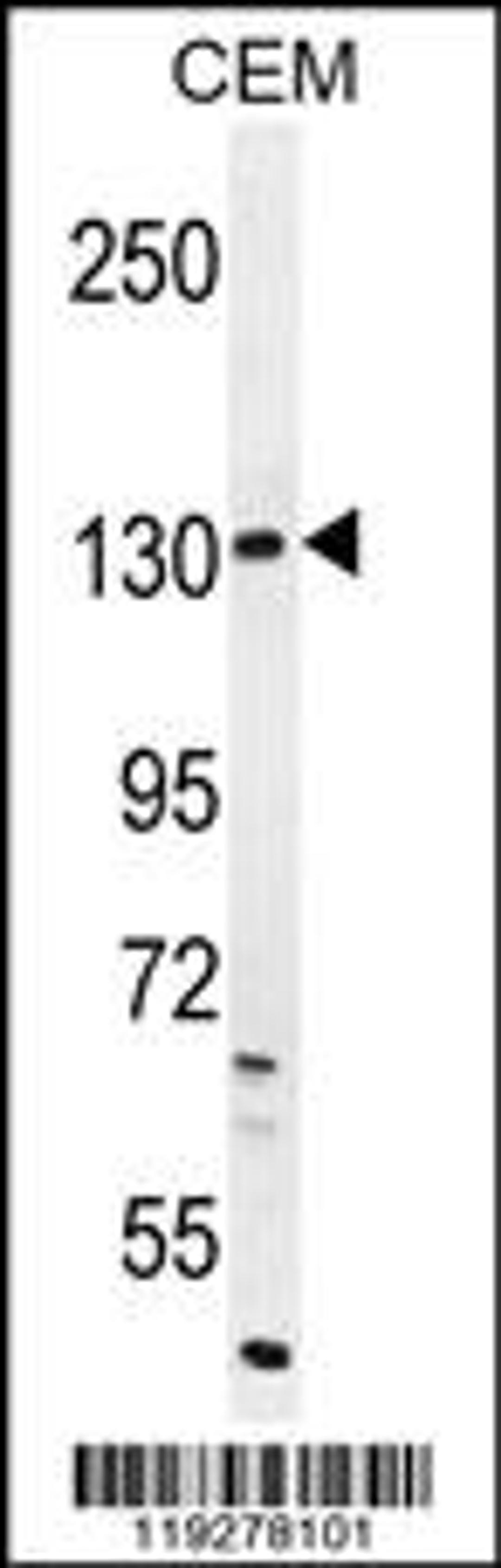 Western blot analysis in CEM cell line lysates (35ug/lane).