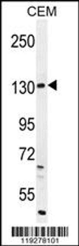 Western blot analysis in CEM cell line lysates (35ug/lane).