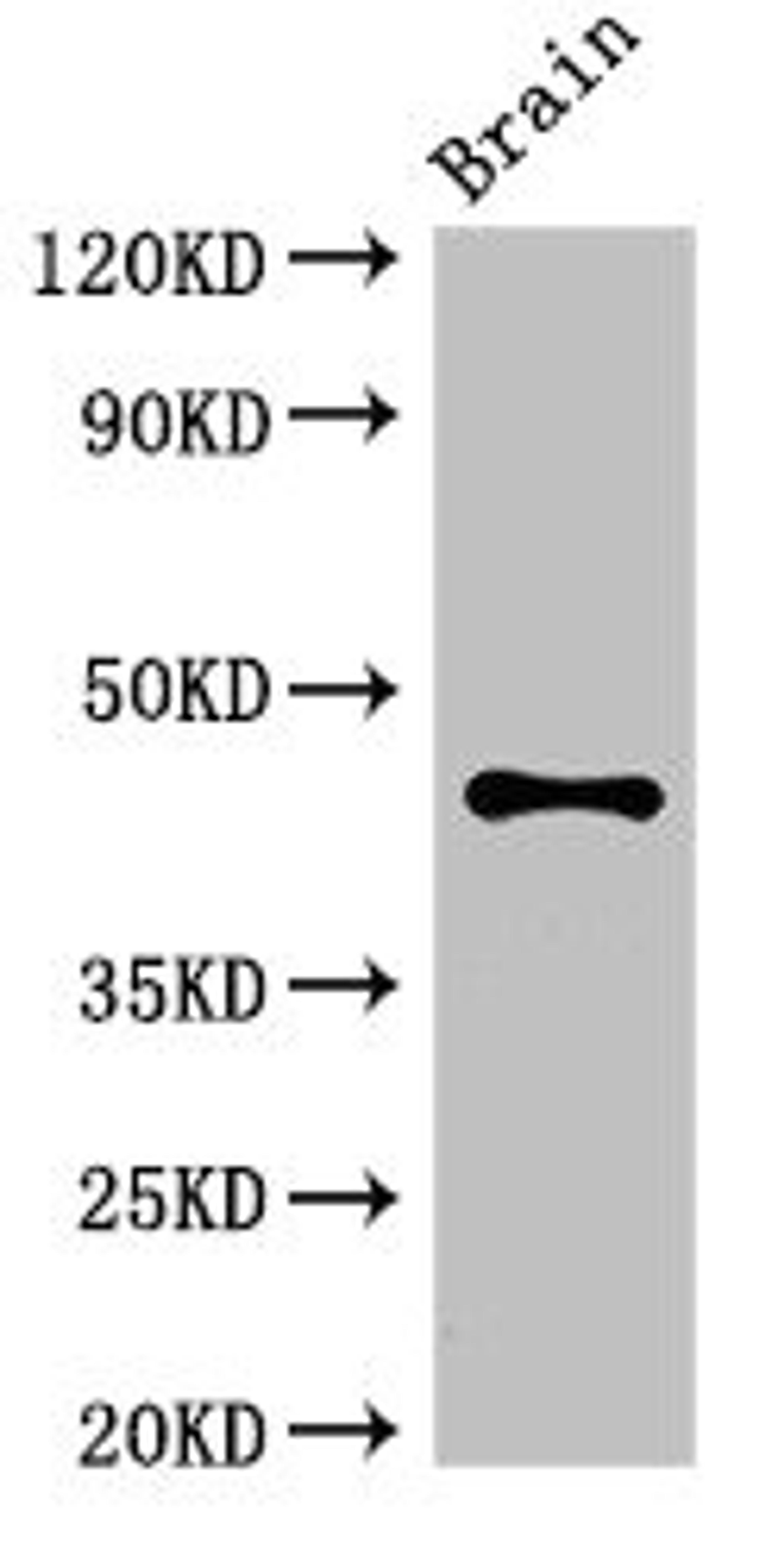 Western Blot. Positive WB detected in: Mouse brain tissue. All lanes: ATG4B antibody at 3.4ug/ml. Secondary. Goat polyclonal to rabbit IgG at 1/50000 dilution. Predicted band size: 45, 53, 32, 38, 43 kDa. Observed band size: 45 kDa.
