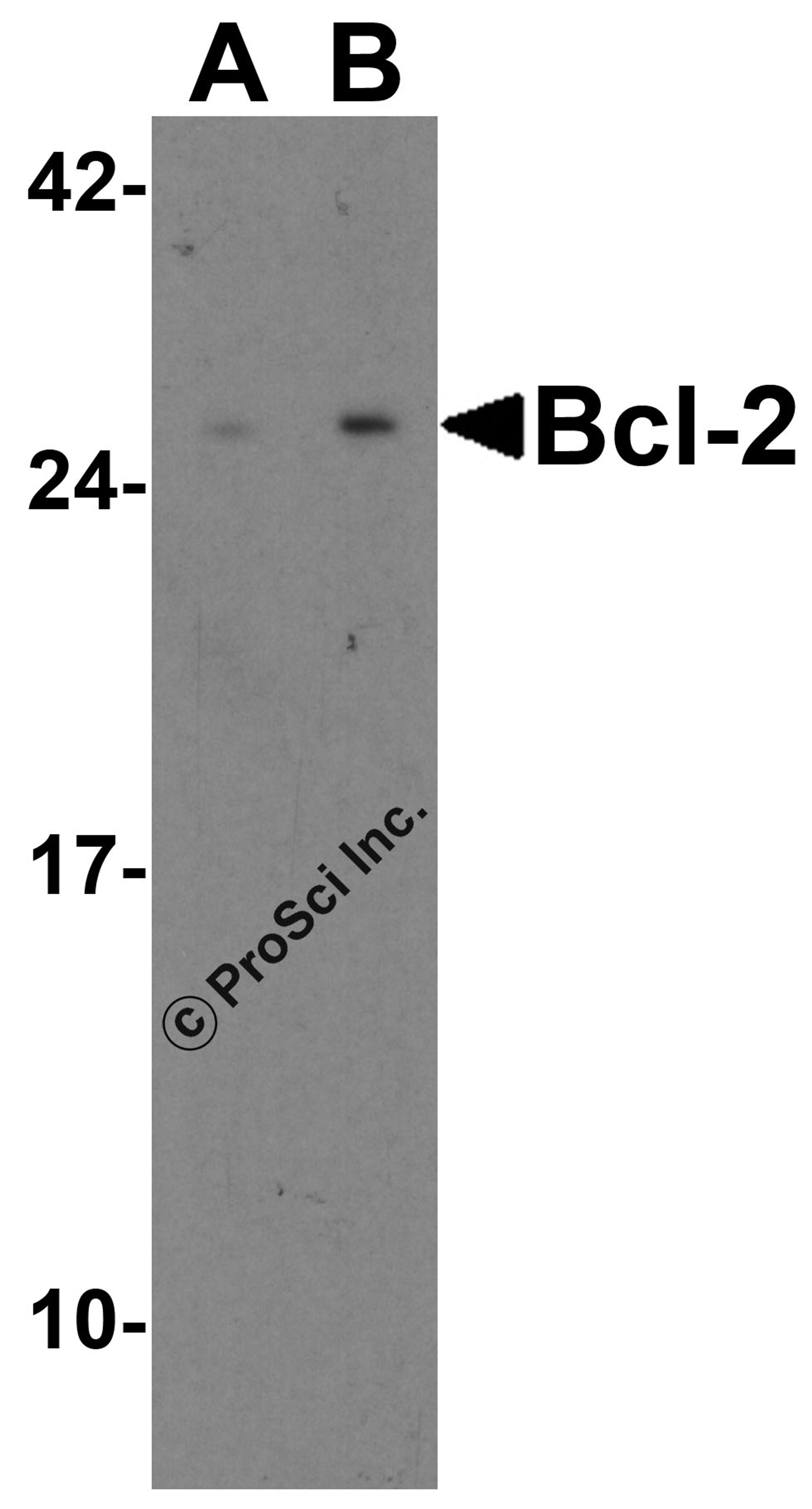 Western blot analysis of Bcl-2 in A-20 cell lysate with Bcl-2 antibody at (A) 1 and (B) 2 &#956;g/mL.