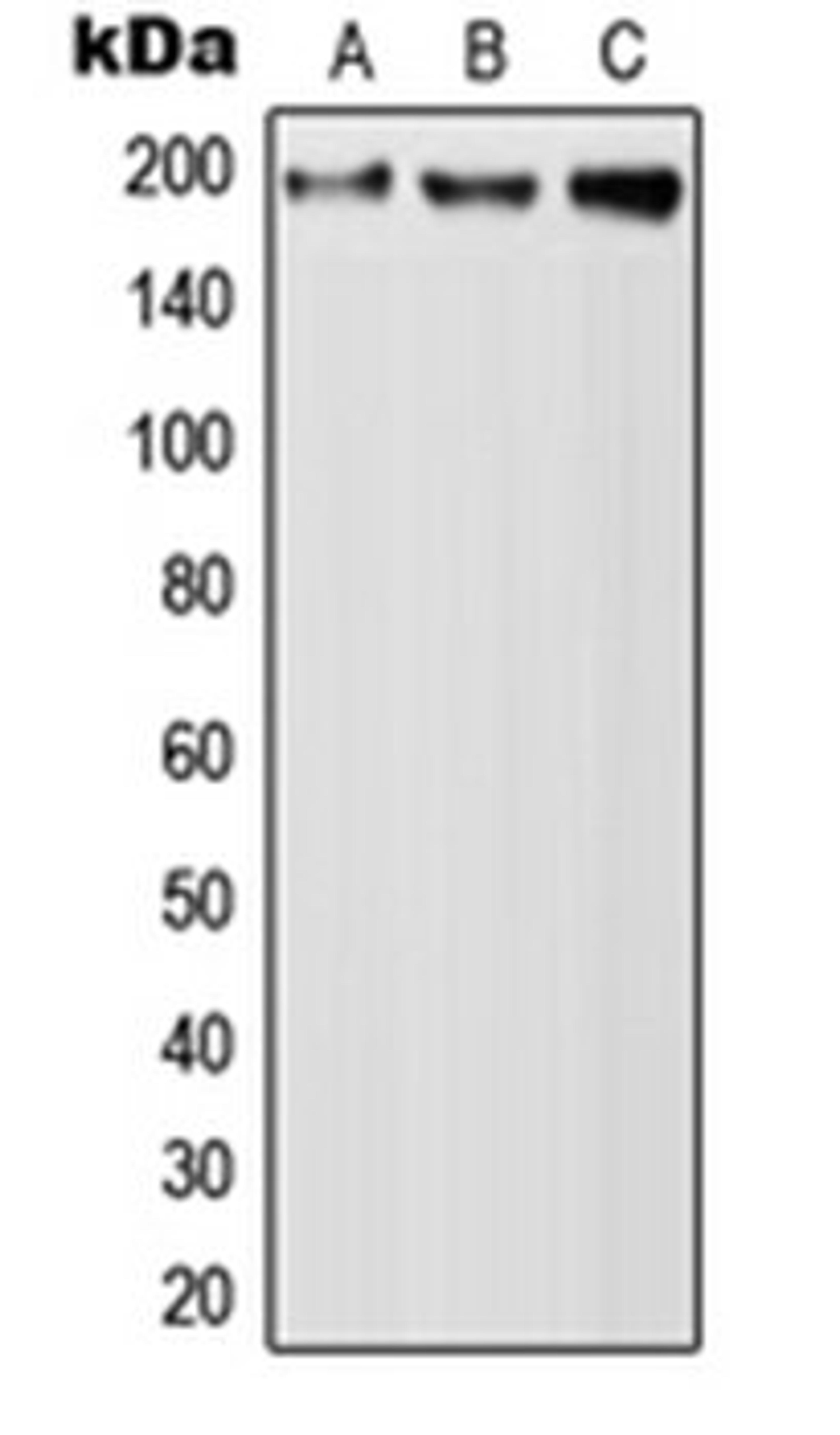 Western blot analysis of A549 (Lane 1), Raw264.7 (Lane 2), PC12 (Lane 3) whole cell lysates using QSER1 antibody