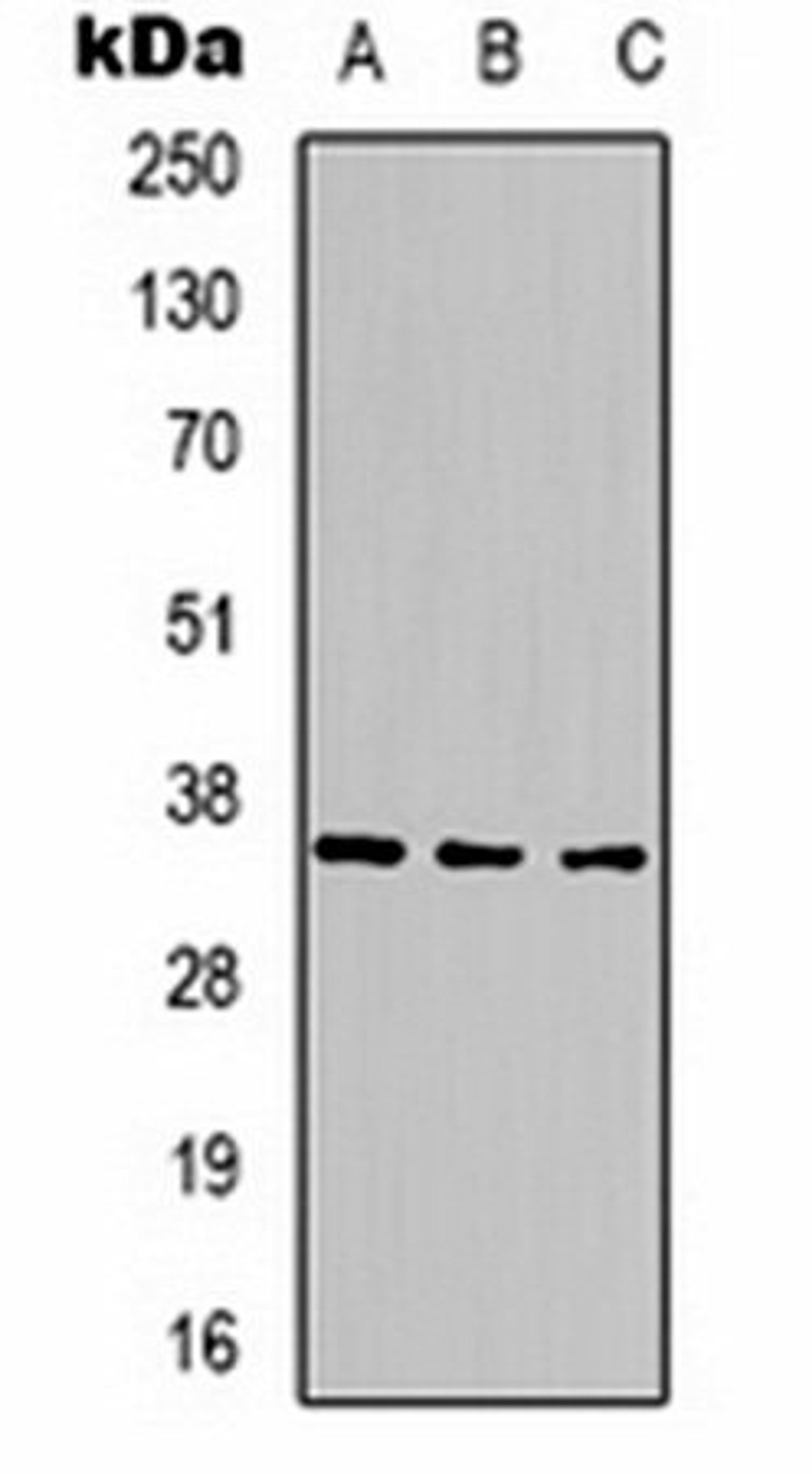 Western blot analysis of 293T (Lane 1), mouse brain (Lane 2), rat brain (Lane 3) whole cell lysates using CABP2 antibody