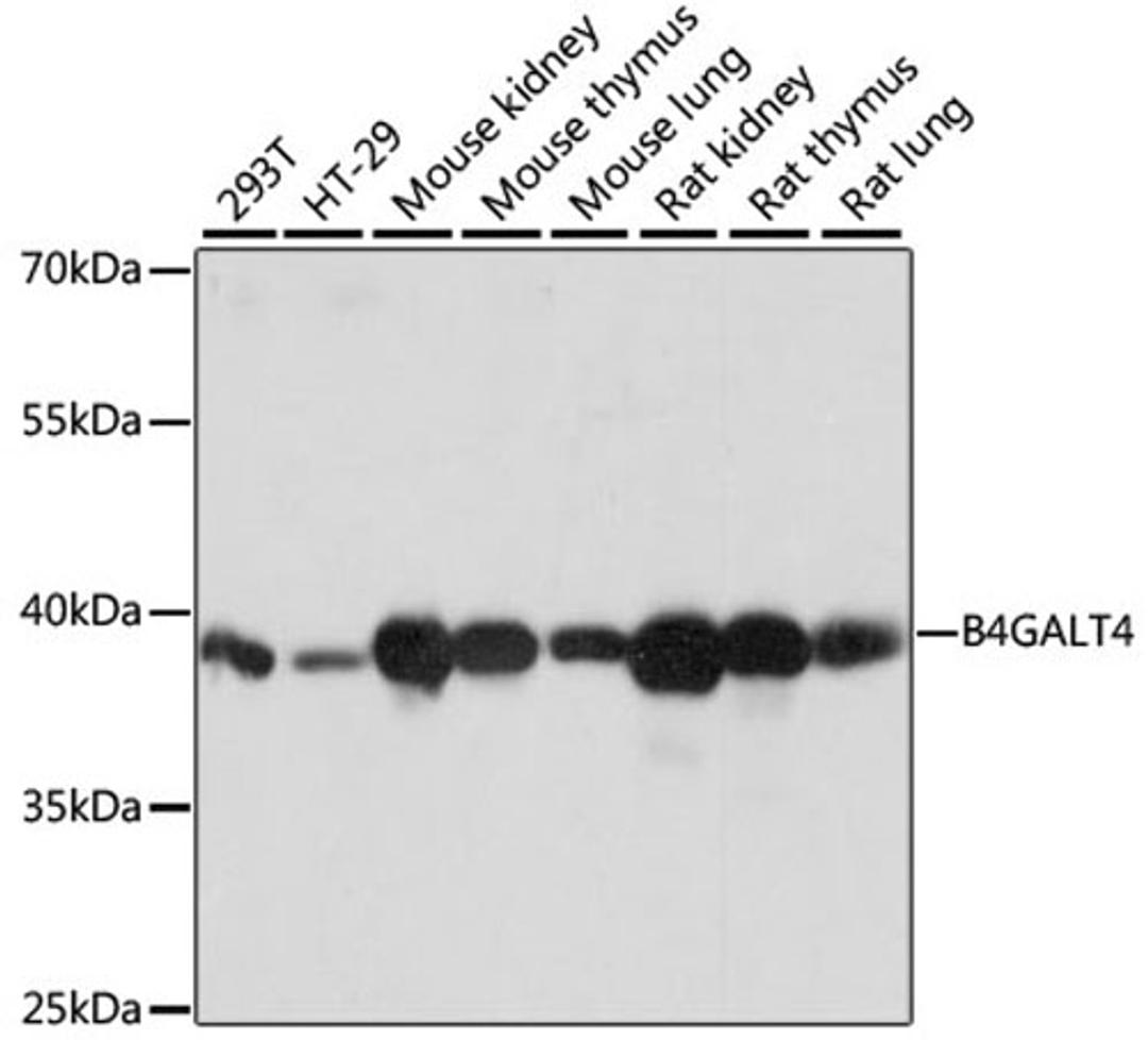 Western blot - B4GALT4 antibody (A14693)