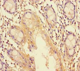 Immunohistochemistry of paraffin-embedded human colon tissue using CSB-PA024474LA01HU at dilution of 1:100
