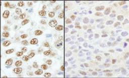 Detection of human and mouse RBM25/RED120 by immunohistochemistry.