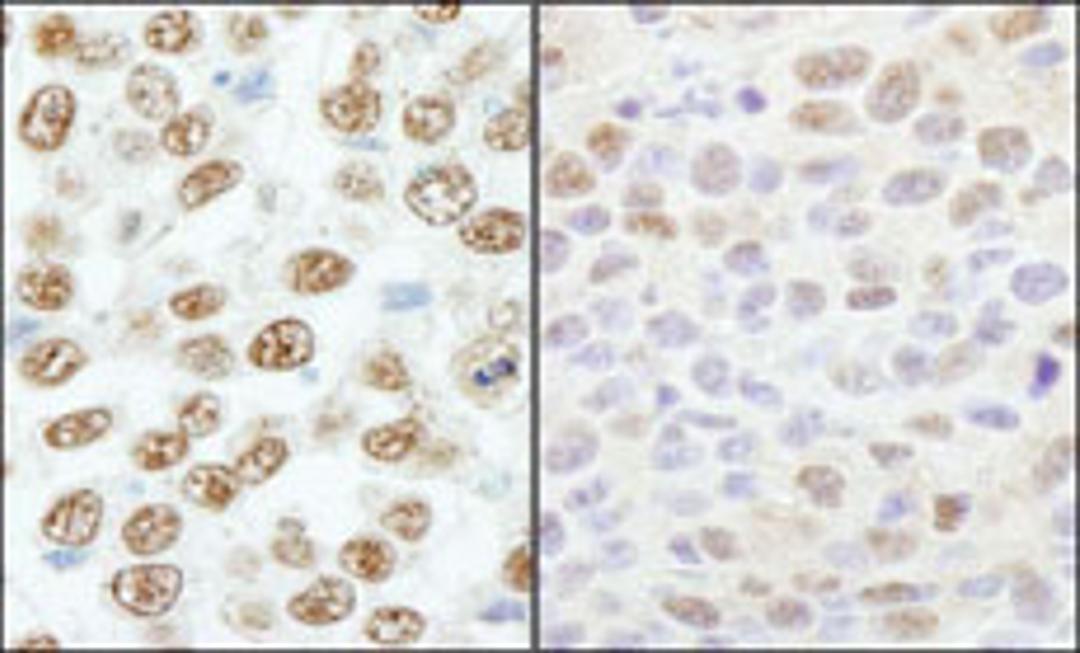 Detection of human and mouse RBM25/RED120 by immunohistochemistry.