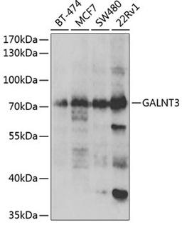 Western blot - GALNT3 antibody (A6596)