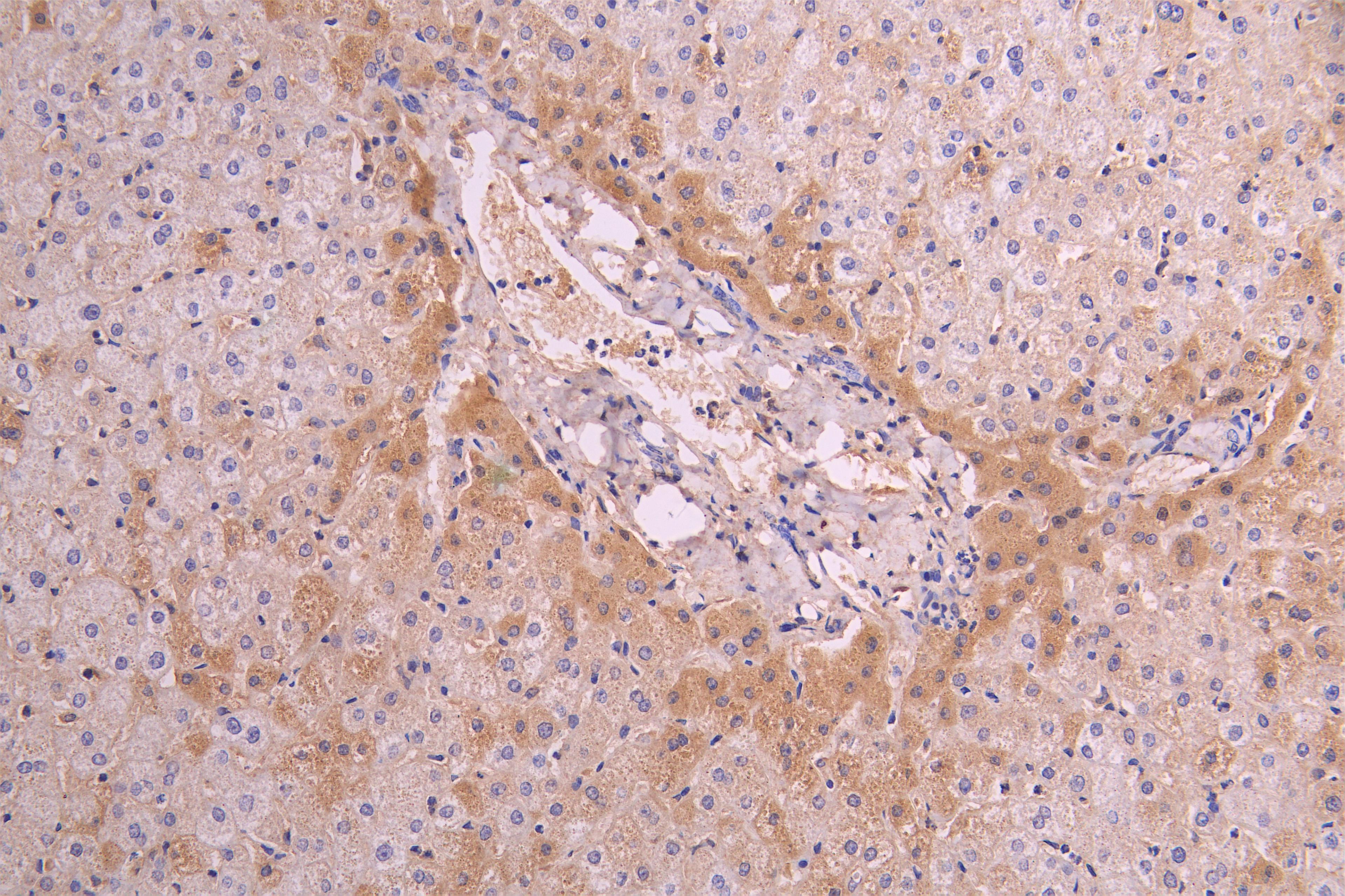 IHC image of CSB-RA004879MA1HU diluted at 1：100 and staining in paraffin-embedded human liver tissue performed on a Leica BondTM system. After dewaxing and hydration, antigen retrieval was mediated by high pressure in a citrate buffer (pH 6.0). Section was blocked with 10% normal goat serum 30min at RT. Then primary antibody (1% BSA) was incubated at 4°C overnight. The primary is detected by a Goat anti-human polymer IgG labeled by HRP and visualized using 0.05% DAB.