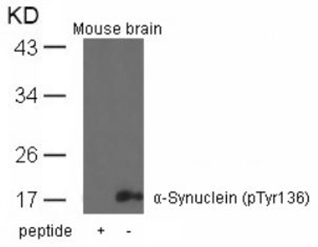 Western blot analysis of lysed extracts from mouse brain tissue using &#945;-Synuclein (Phospho-Tyr136).