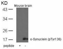 Western blot analysis of lysed extracts from mouse brain tissue using &#945;-Synuclein (Phospho-Tyr136).