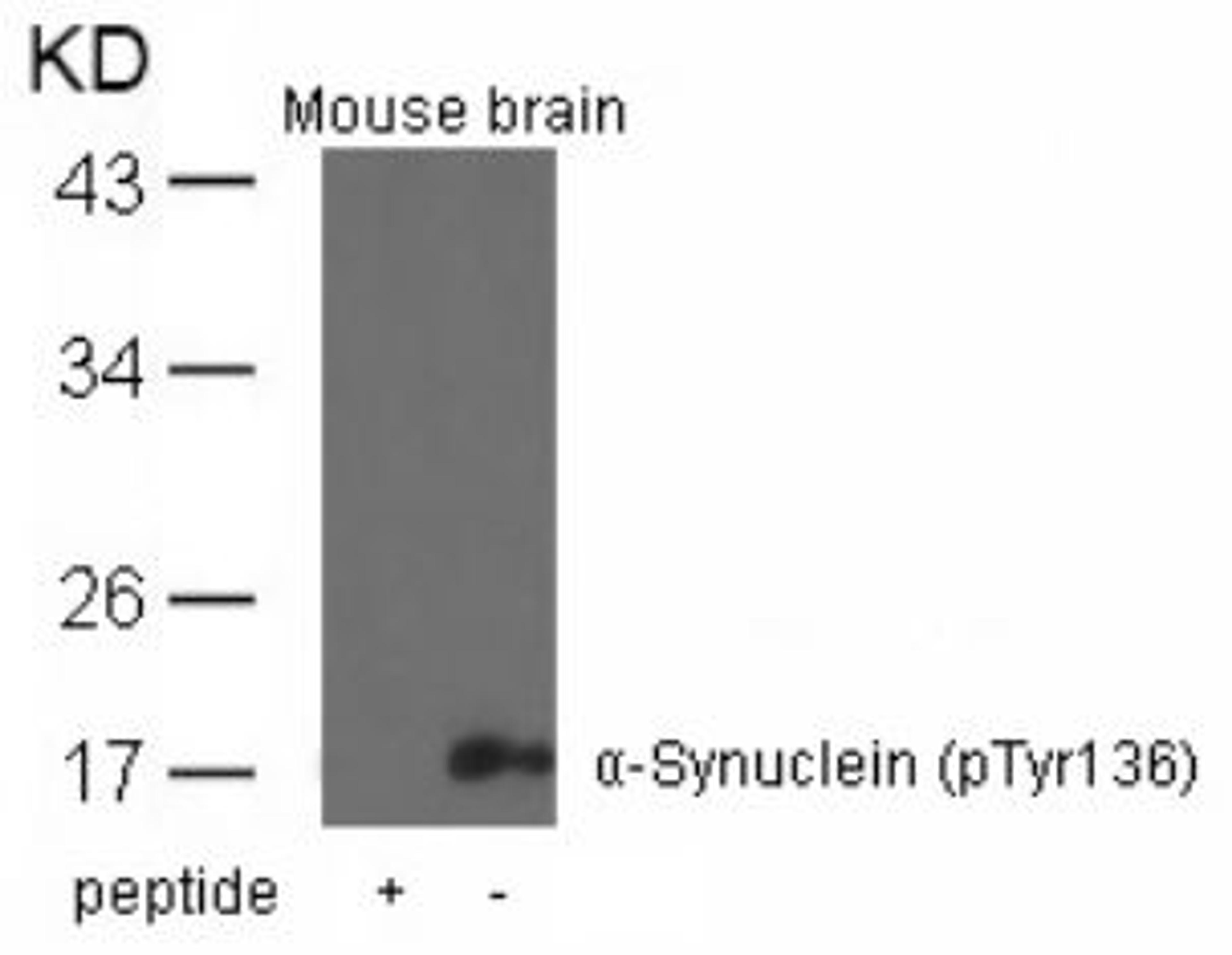 Western blot analysis of lysed extracts from mouse brain tissue using &#945;-Synuclein (Phospho-Tyr136).