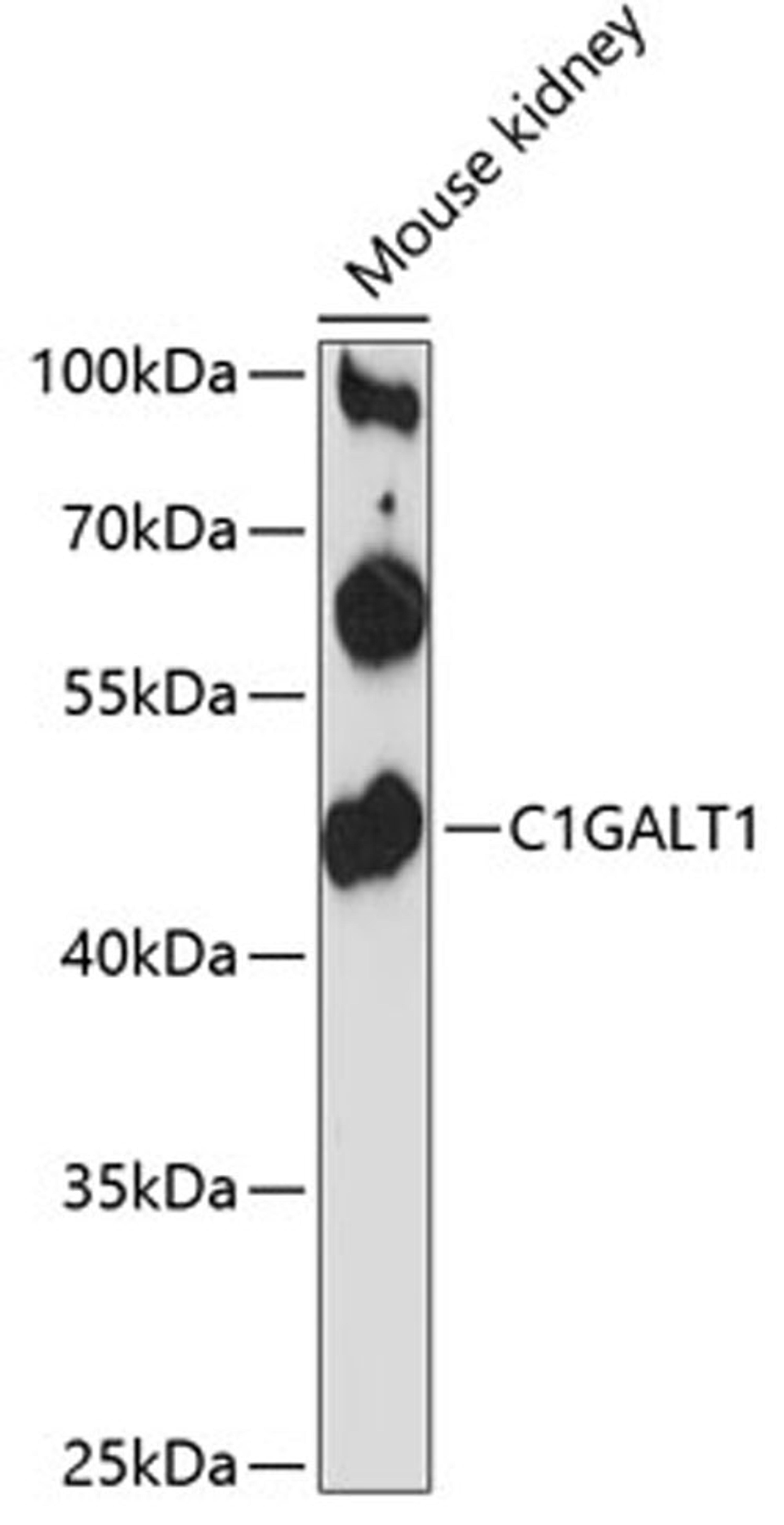 Western blot - C1GALT1 antibody (A12865)