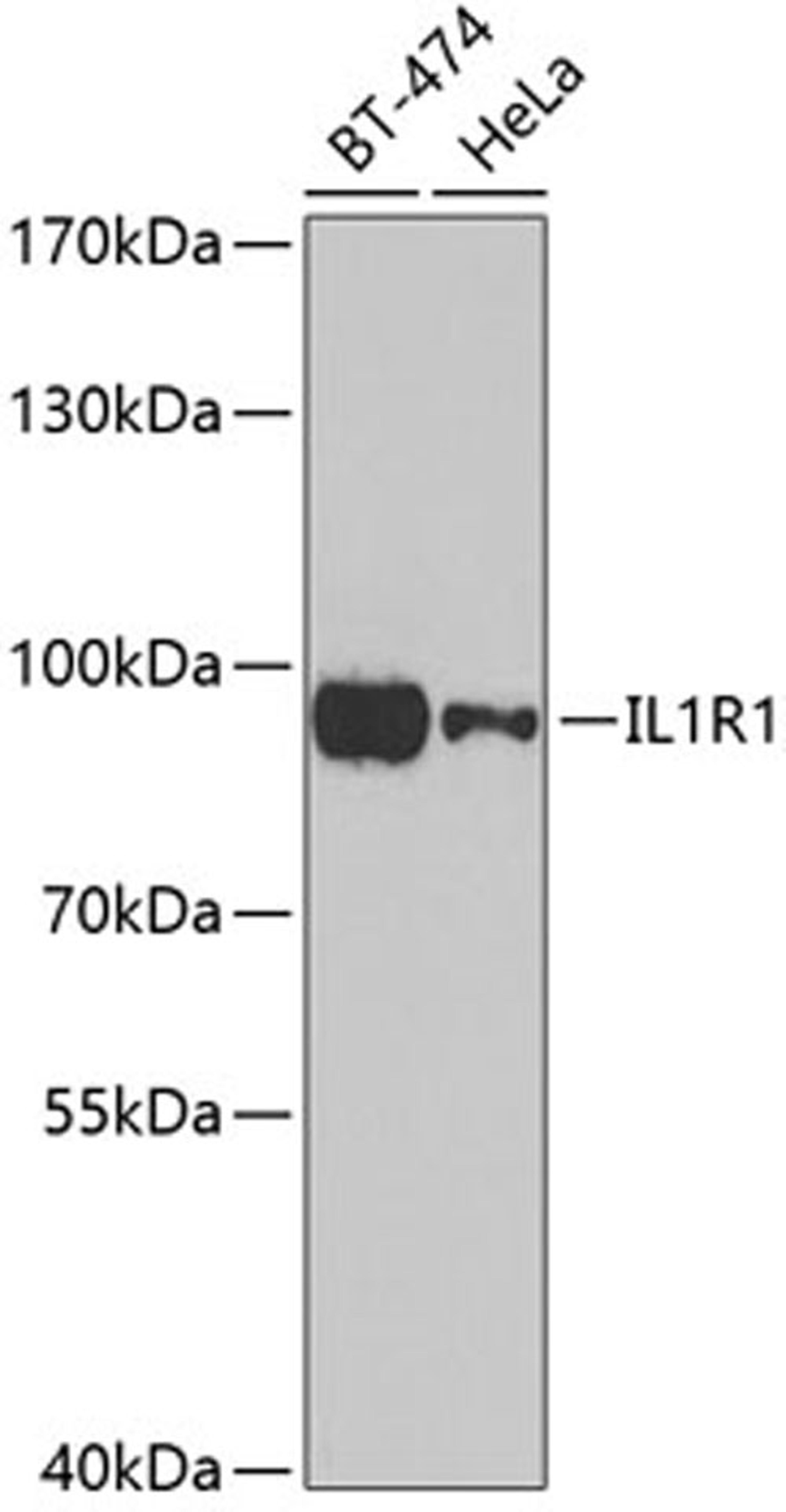 Western blot - IL1R1 antibody (A5727)