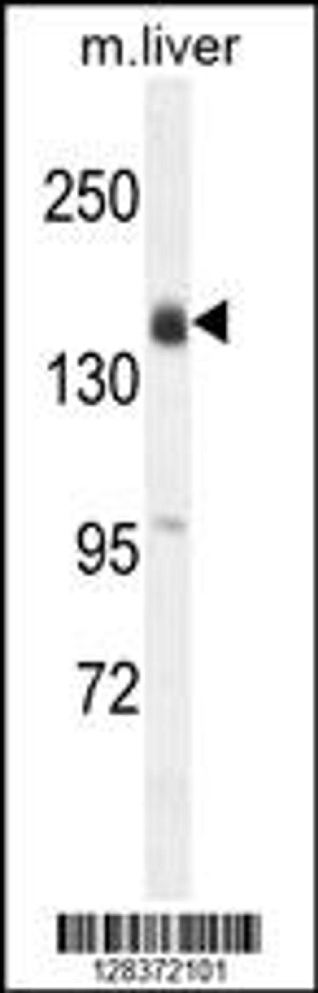 Western blot analysis in mouse liver tissue lysates (35ug/lane).