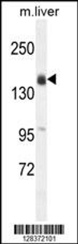 Western blot analysis in mouse liver tissue lysates (35ug/lane).