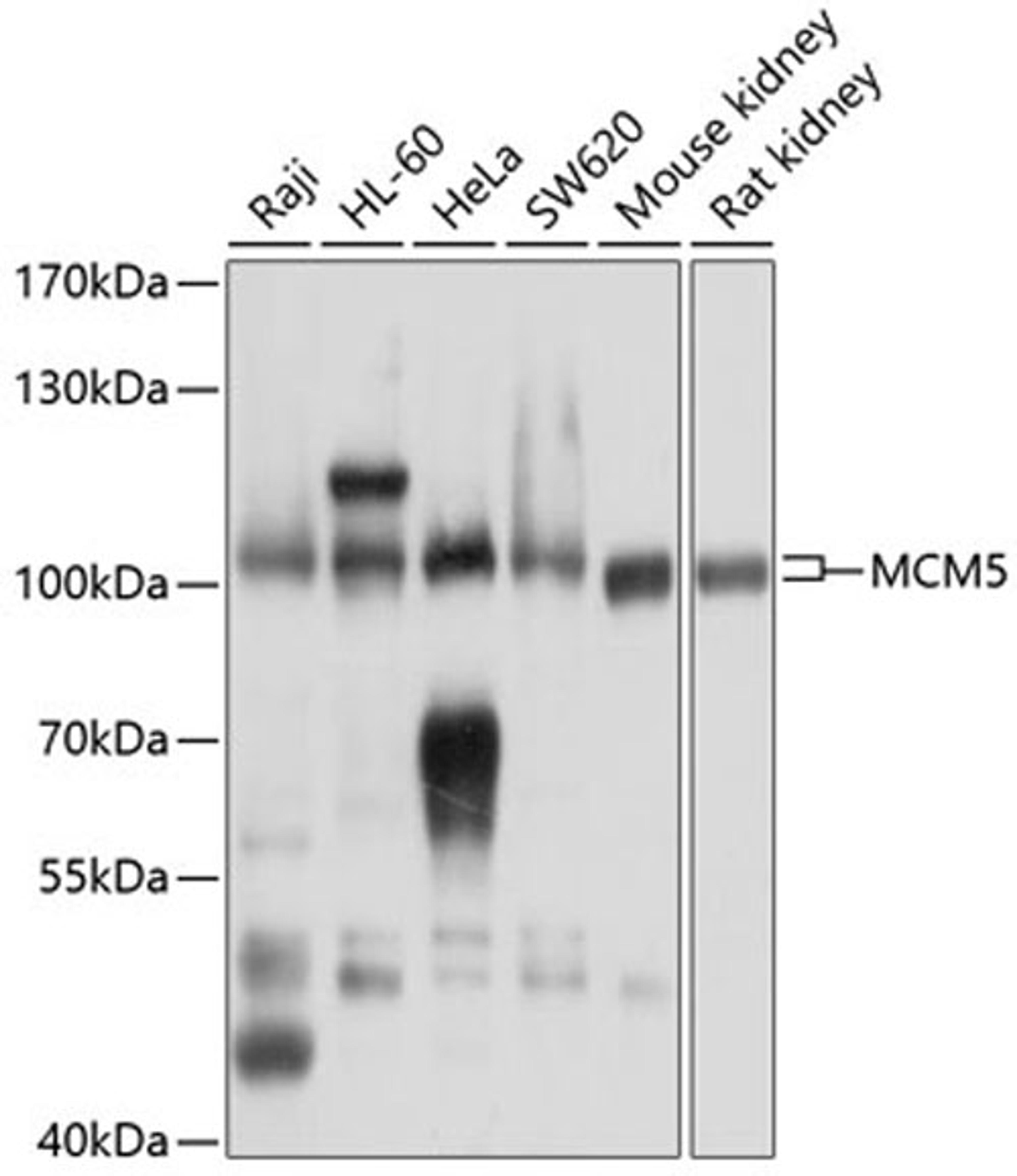 Western blot - MCM5 antibody (A13514)