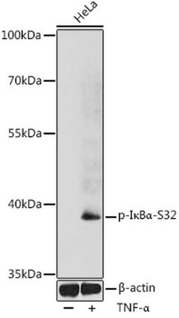 Western blot - Phospho-I?Ba-S32 antibody (AP0731)