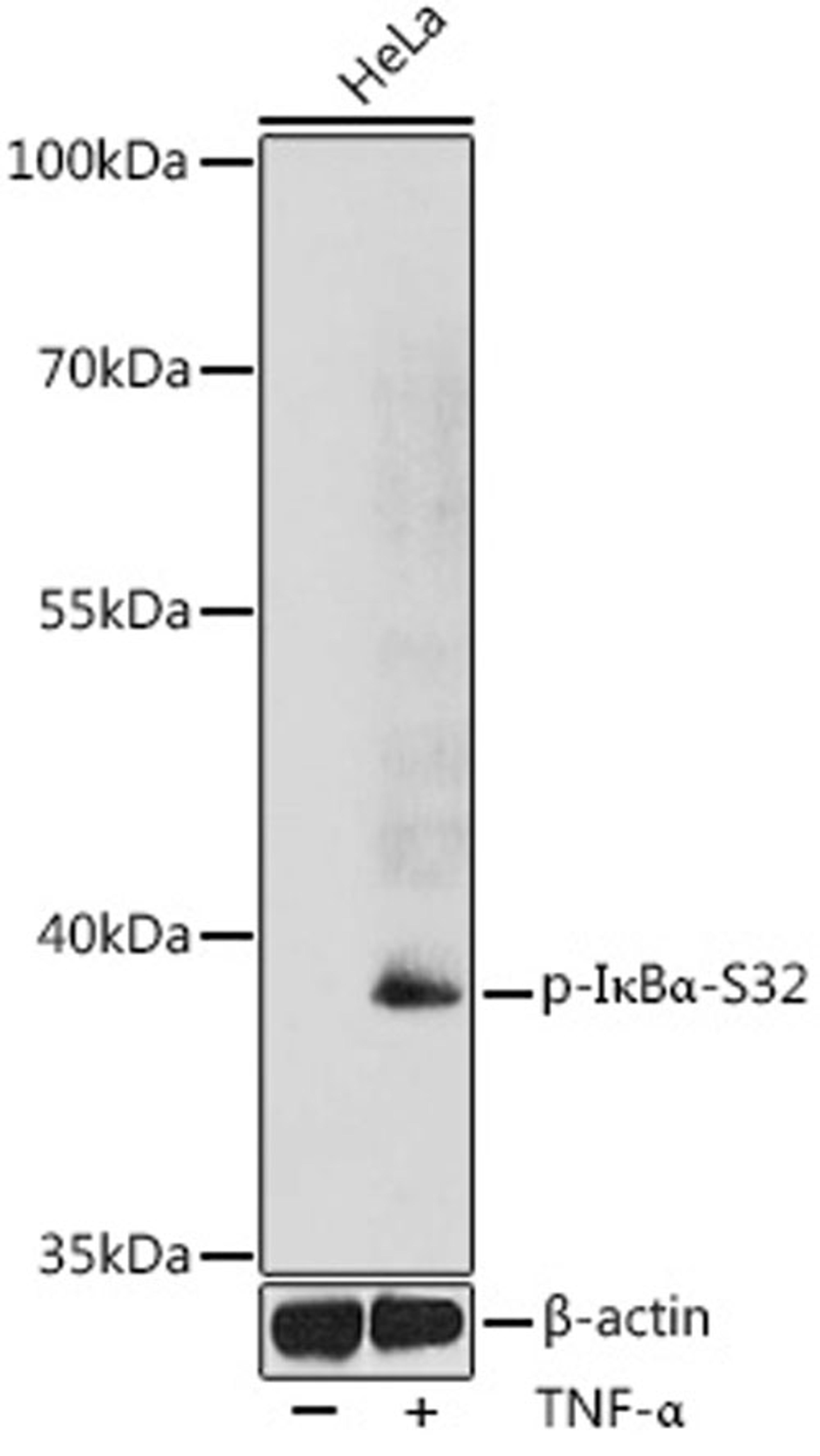 Western blot - Phospho-I?Ba-S32 antibody (AP0731)