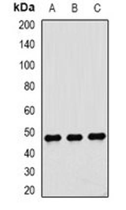 Western blot analysis of Jurkat (Lane1), HepG2 (Lane2), MCF7 (Lane3) whole cell lysates using DTNBP1 antibody