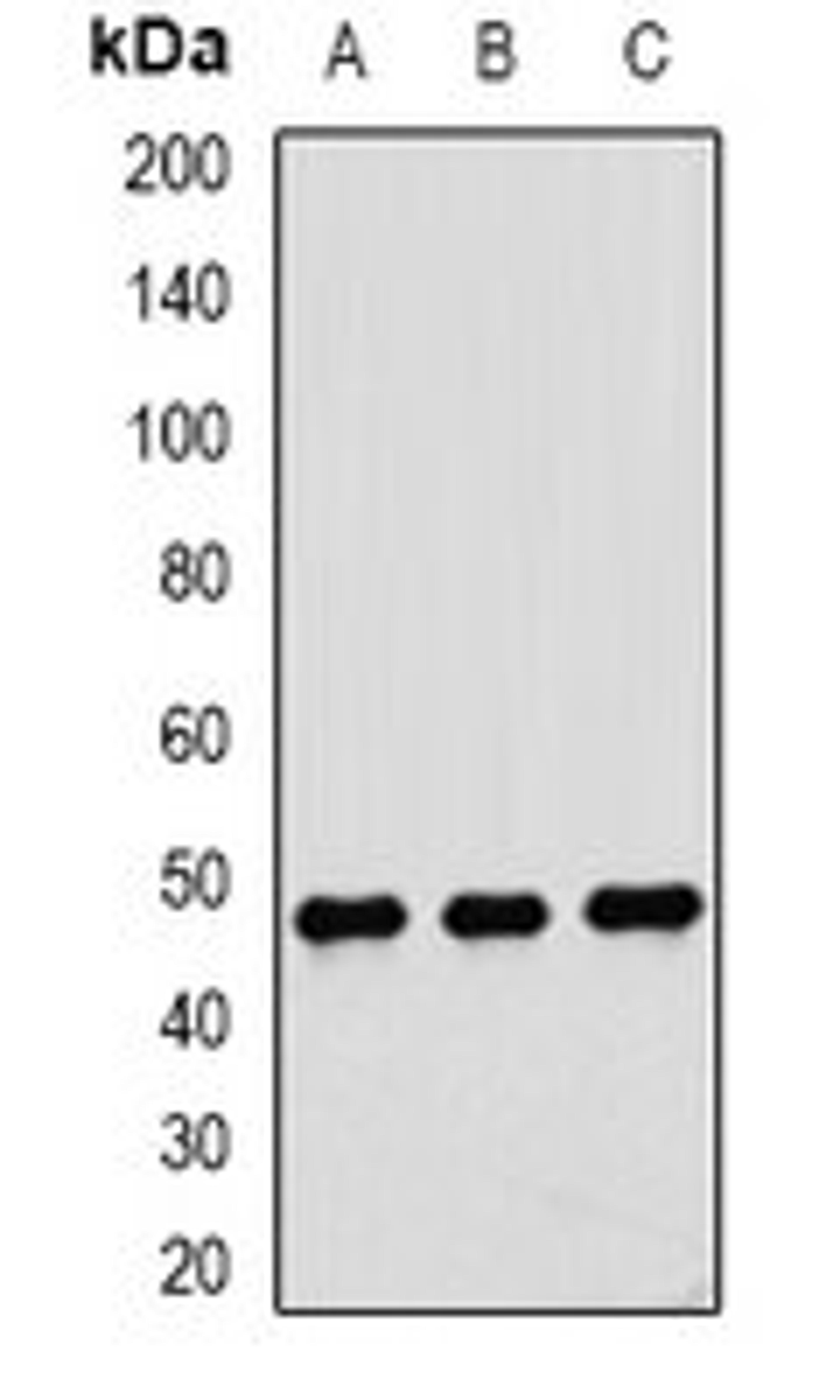 Western blot analysis of Jurkat (Lane1), HepG2 (Lane2), MCF7 (Lane3) whole cell lysates using DTNBP1 antibody