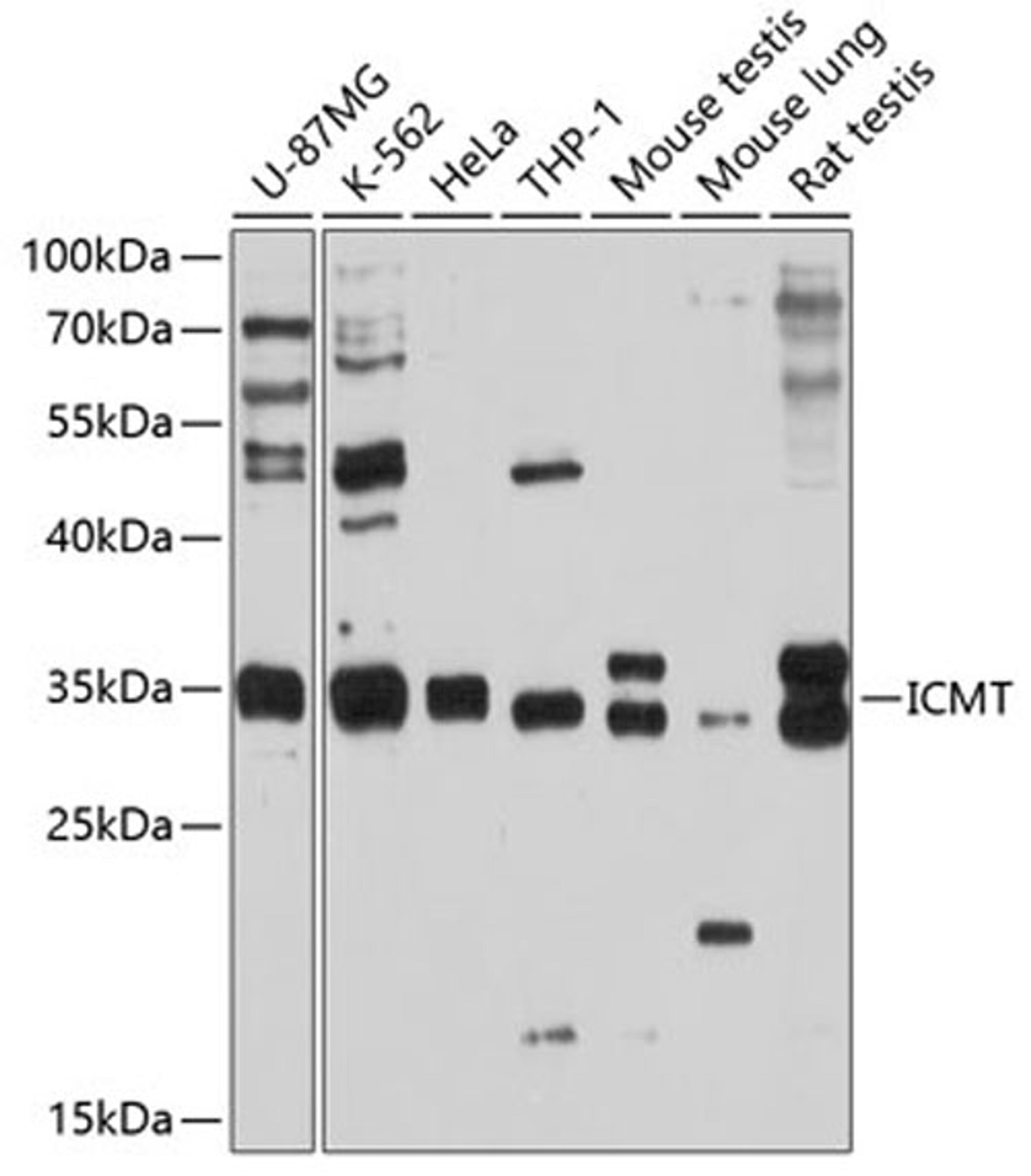 Western blot - ICMT antibody (A10293)