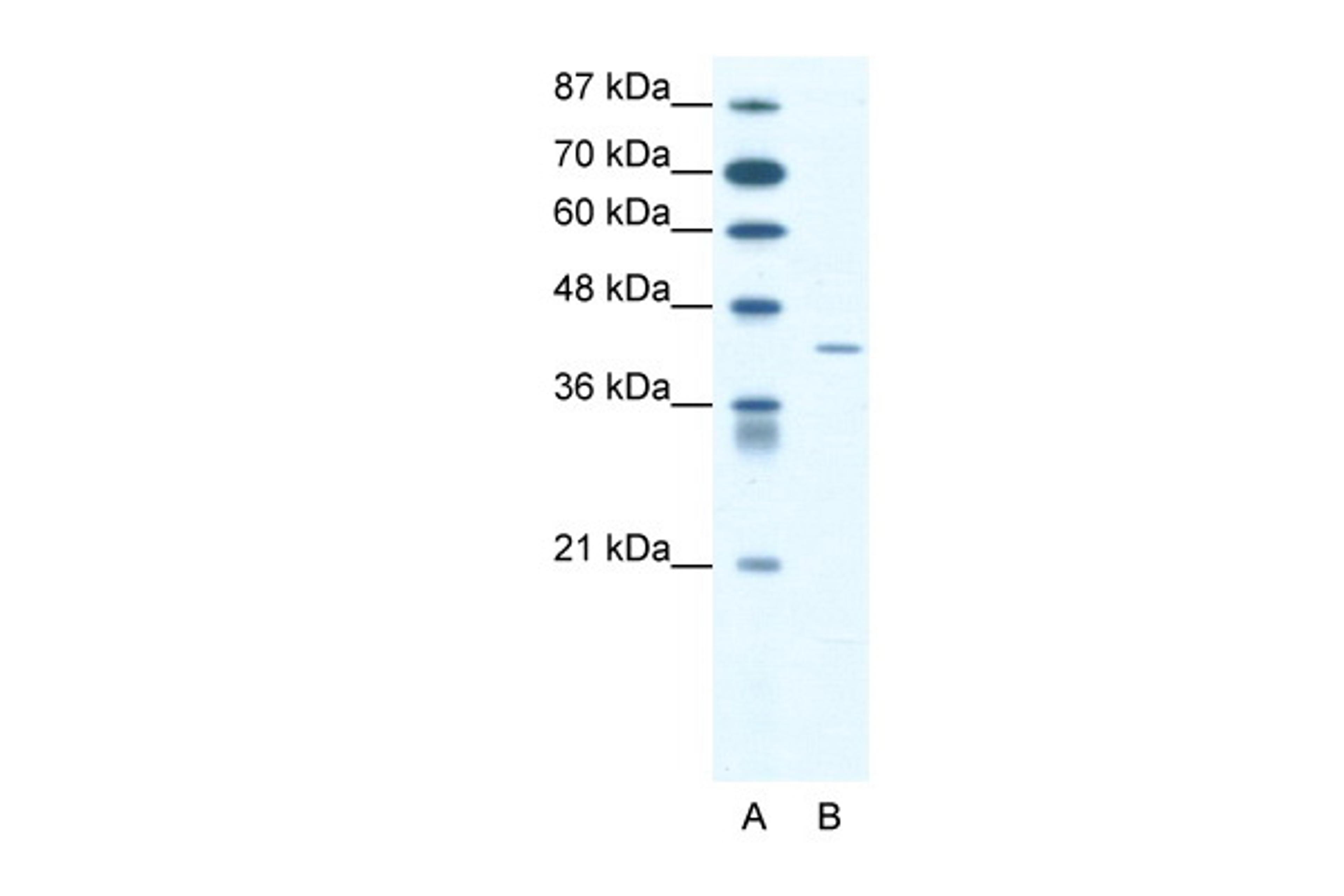 Antibody used in WB on Human Jurkat 1.25 ug/ml.