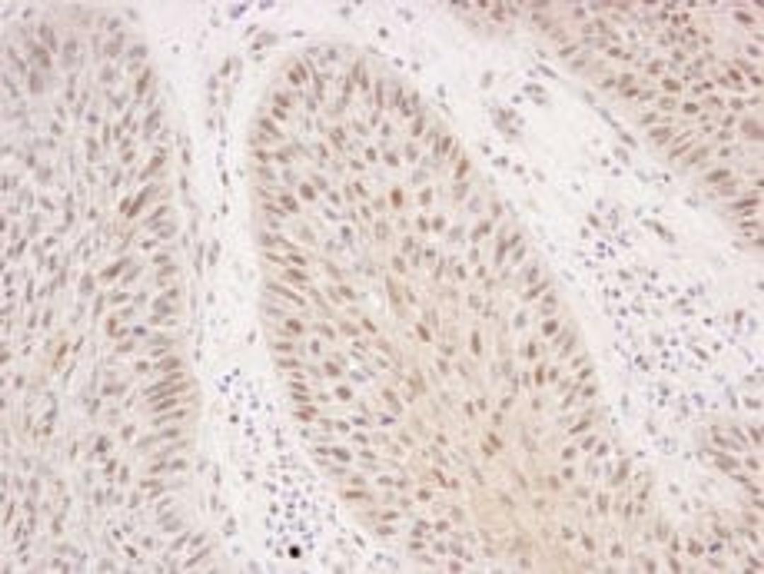 Detection of human Rad50 by immunohistochemistry.