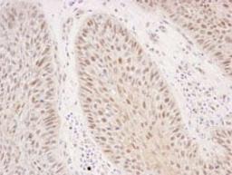 Detection of human Rad50 by immunohistochemistry.