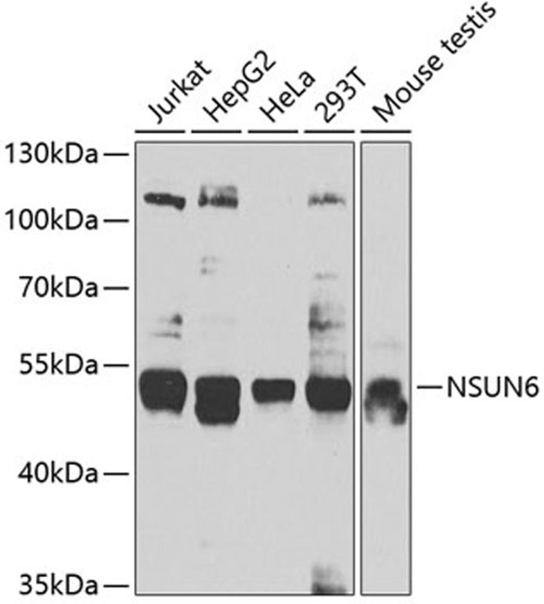 Western blot - NSUN6 antibody (A7205)