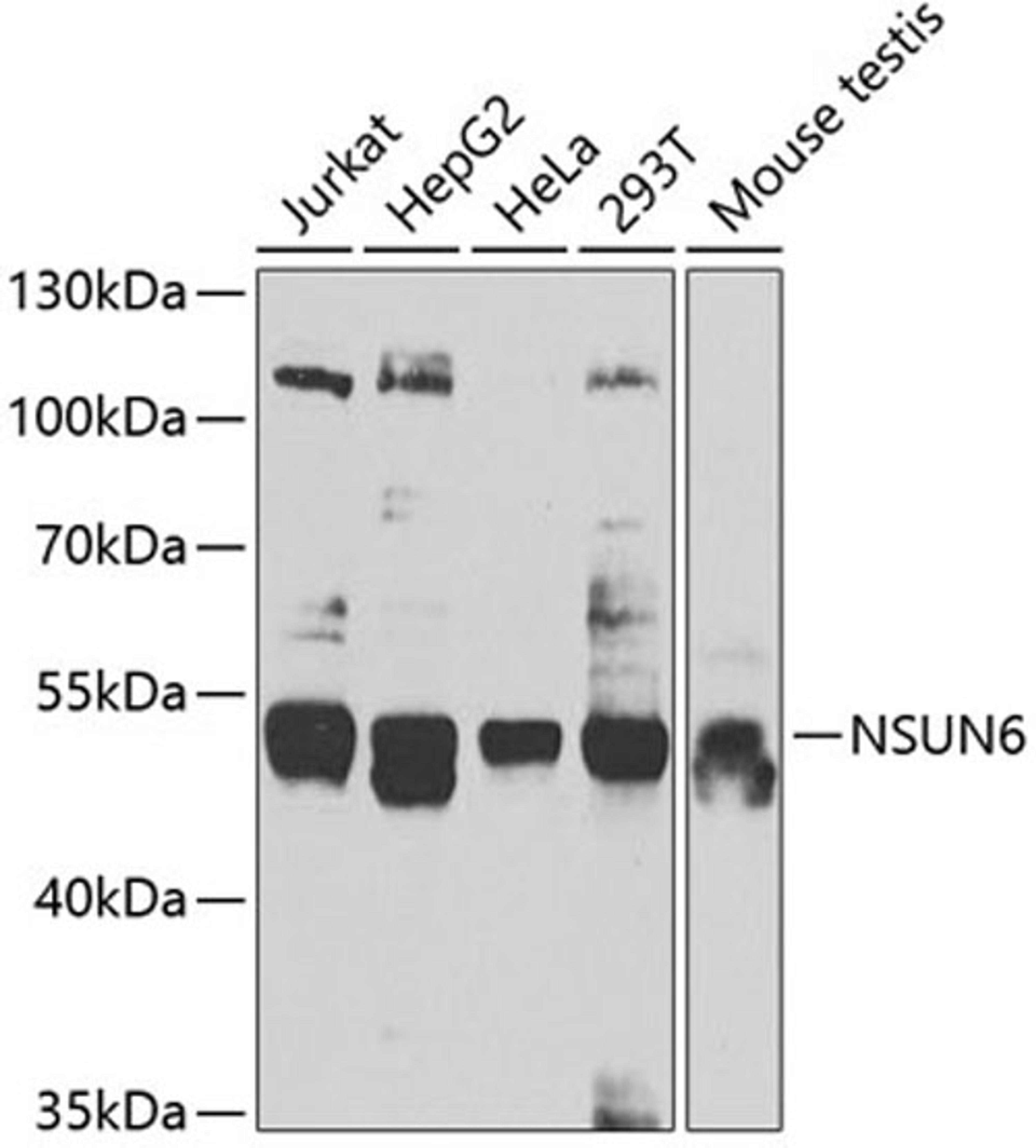 Western blot - NSUN6 antibody (A7205)