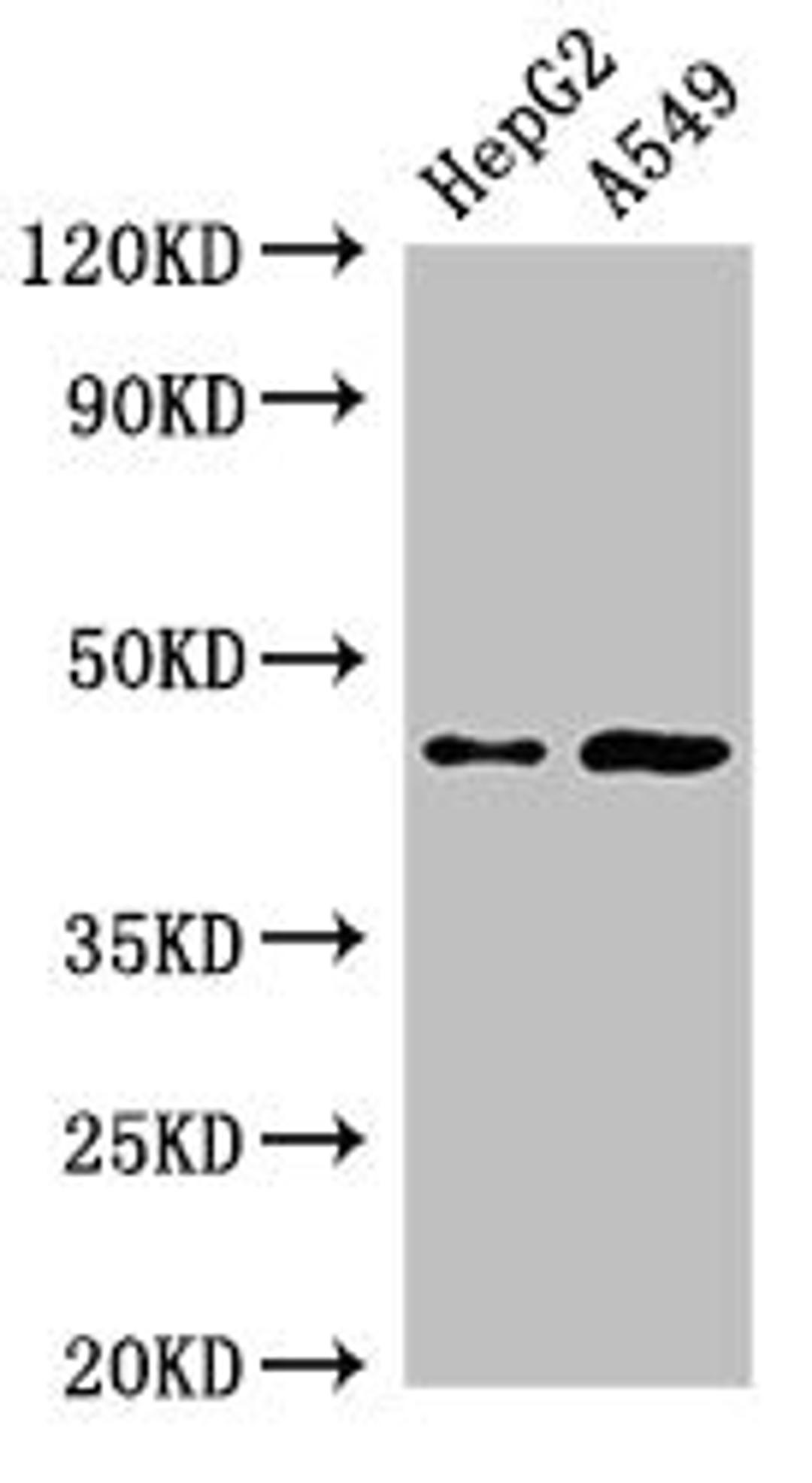 Western Blot. Positive WB detected in: HepG2 whole cell lysate, A549 whole cell lysate. All lanes: PIGK antibody at 2.5µg/ml. Secondary. Goat polyclonal to rabbit IgG at 1/50000 dilution. Predicted band size: 46, 37 kDa. Observed band size: 46 kDa
