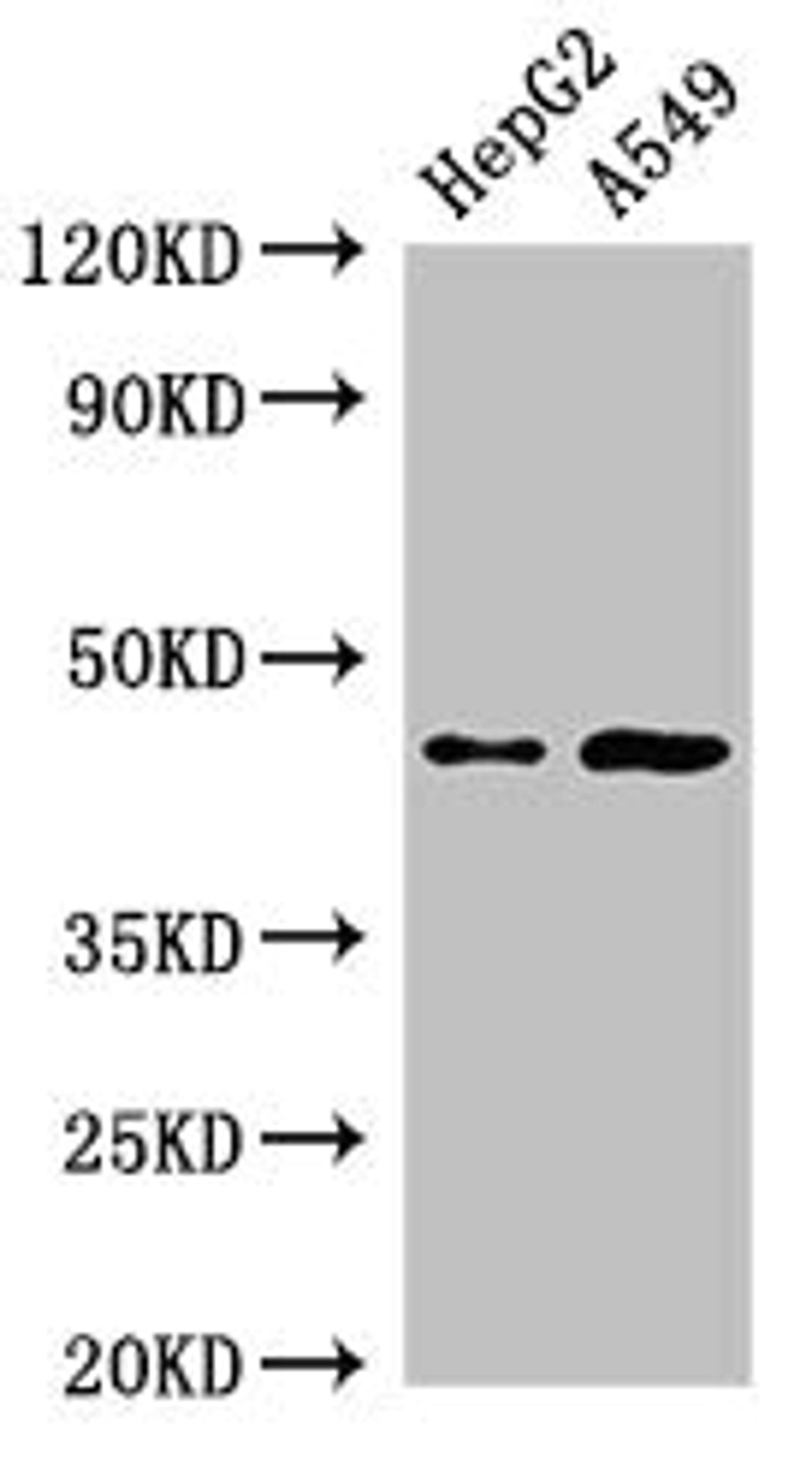 Western Blot. Positive WB detected in: HepG2 whole cell lysate, A549 whole cell lysate. All lanes: PIGK antibody at 2.5µg/ml. Secondary. Goat polyclonal to rabbit IgG at 1/50000 dilution. Predicted band size: 46, 37 kDa. Observed band size: 46 kDa