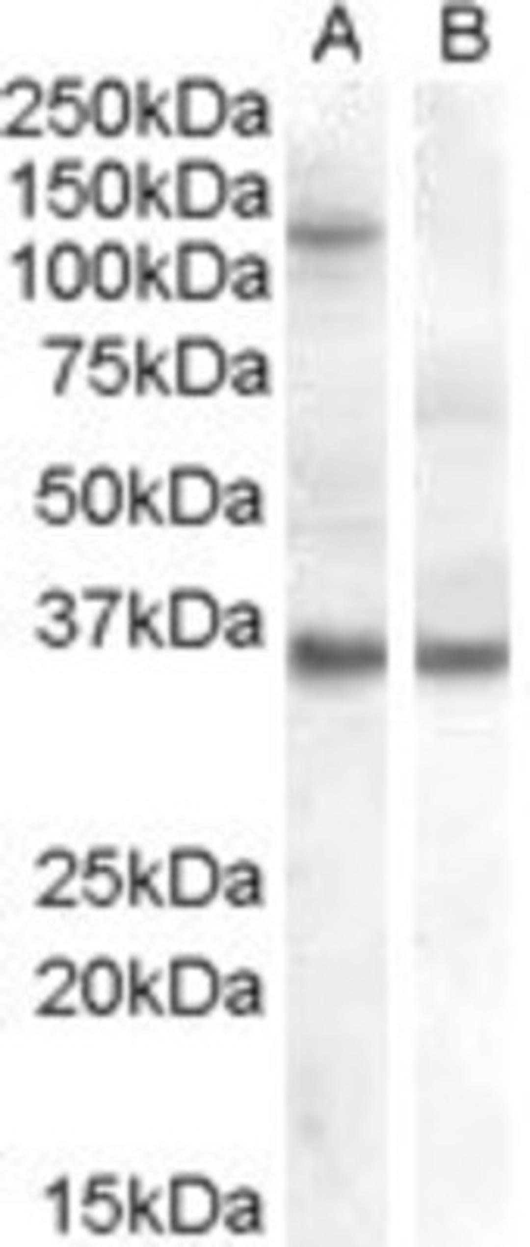 Western Blot: AGO1/EIF2C1 Antibody [NB100-2817] - HEK293 overexpressing AGO1/EIF2C1 and probed with NB100-2817 (non-transfected HEK293 in lane B).