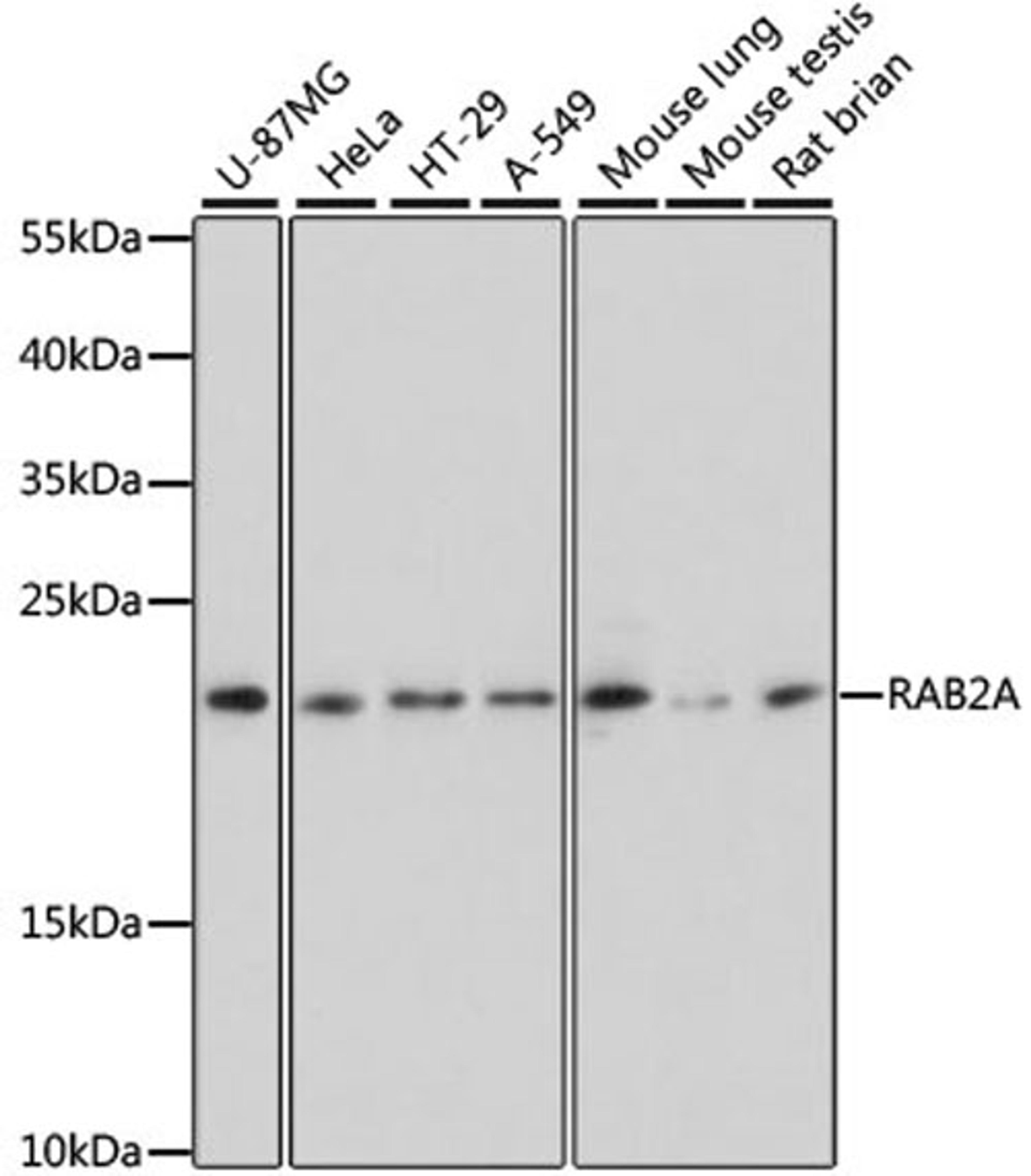 Western blot - RAB2A antibody (A11634)