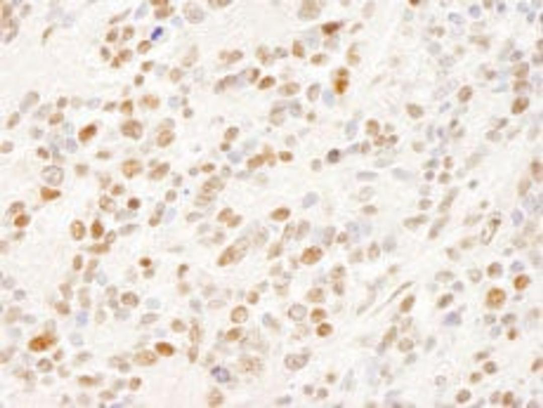 Detection of human SFRS14 by immunohistochemistry.