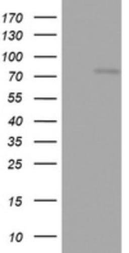 Western Blot: OAS2 Antibody (6E6) [NBP2-46293] - Analysis of HEK293T cells were transfected with the pCMV6-ENTRY control (Left lane) or pCMV6-ENTRY OAS2.