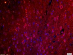 Immunohistochemical staining of rat brain tissue using PCDHGA10 antibody.