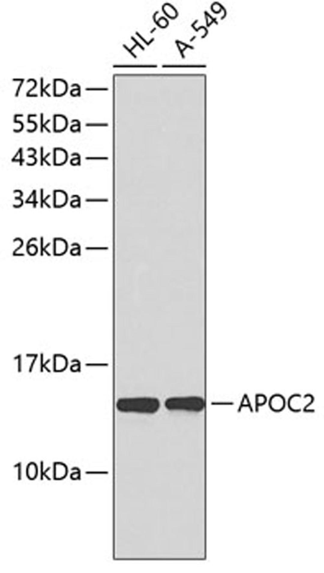 Western blot - APOC2 antibody (A1772)