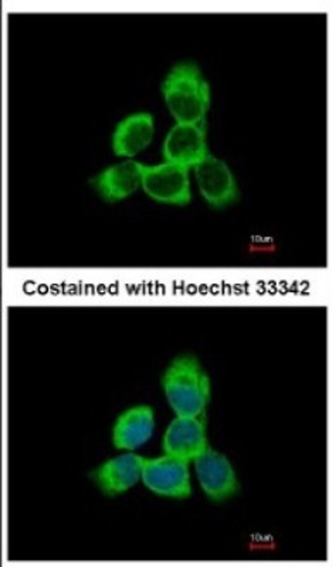 Immunocytochemistry/Immunofluorescence: Cytoglobin Antibody [NBP2-16084] - Immunofluorescence analysis of methanol-fixed A431, using antibody at 1:500 dilution.