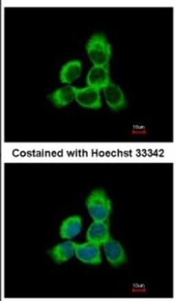 Immunocytochemistry/Immunofluorescence: Cytoglobin Antibody [NBP2-16084] - Immunofluorescence analysis of methanol-fixed A431, using antibody at 1:500 dilution.