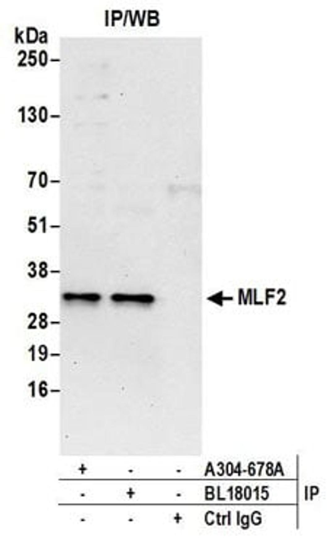 Detection of human MLF2 by western blot of immunoprecipitates.