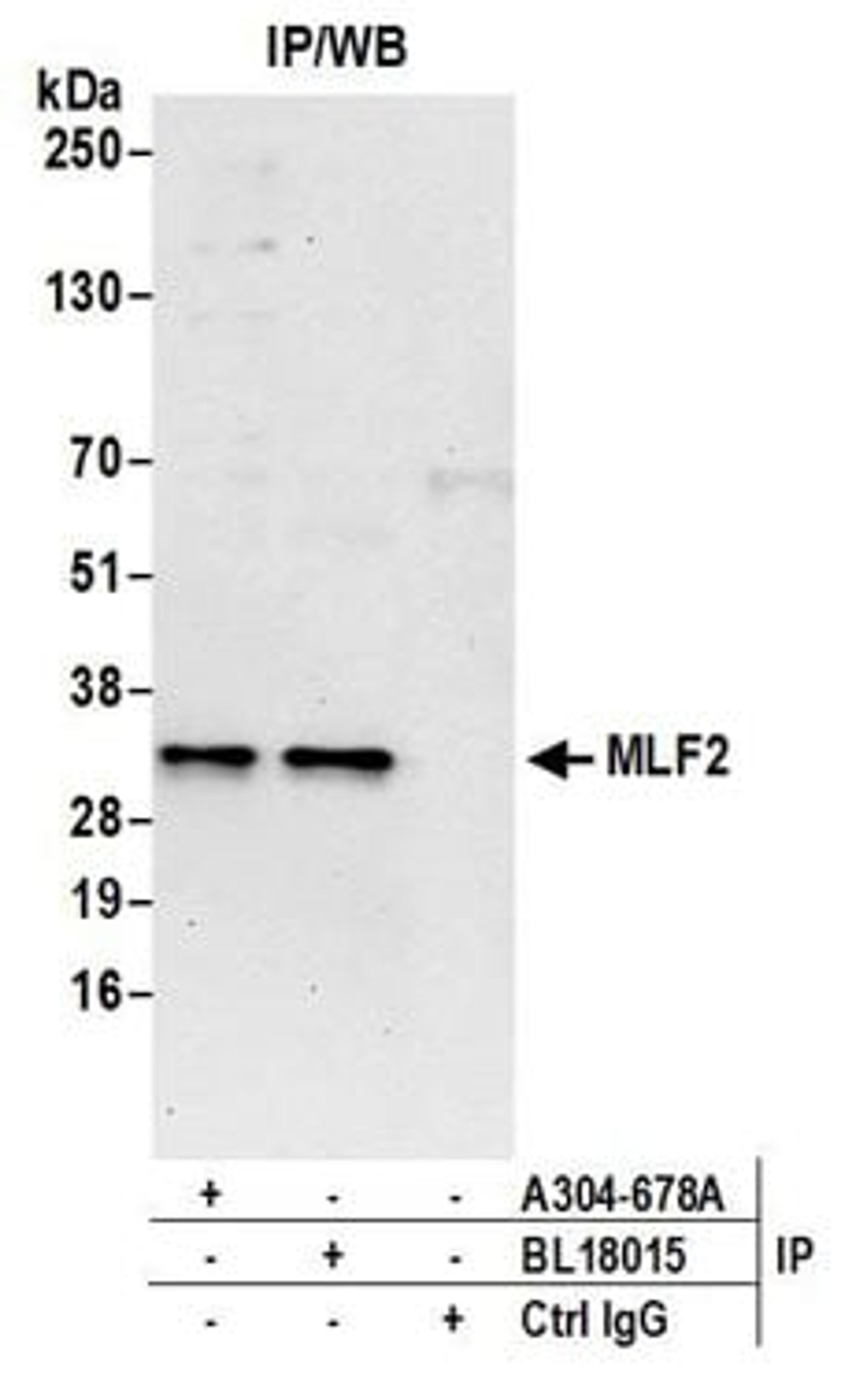 Detection of human MLF2 by western blot of immunoprecipitates.