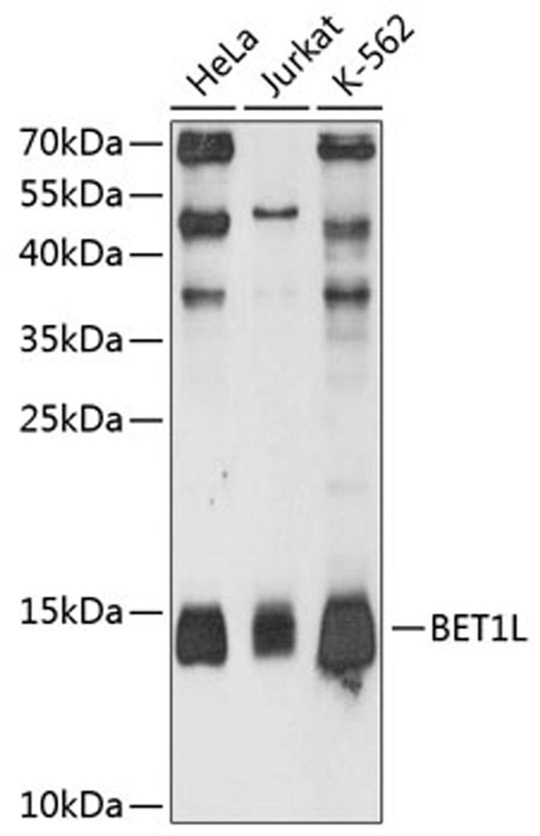 Western blot - BET1L antibody (A11951)